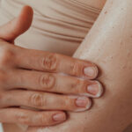 10 Beauty Products and Treatments That Can Trigger a Psoriasis Flare